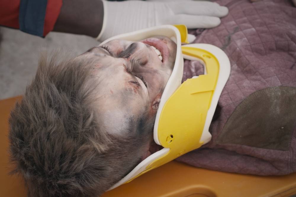 Crop paramedic taking care of teenager